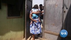 Nigeria's Separated Conjoined Twins Live Normal Lives