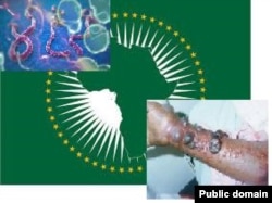 የአፍሪካ ኅብረትና ኢቦላ