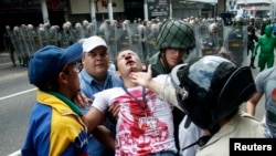 Xalq etirazlarını söndürmək üçün Nikolas Maduro hökuməti polis zorakılıqlarına arxalanır.