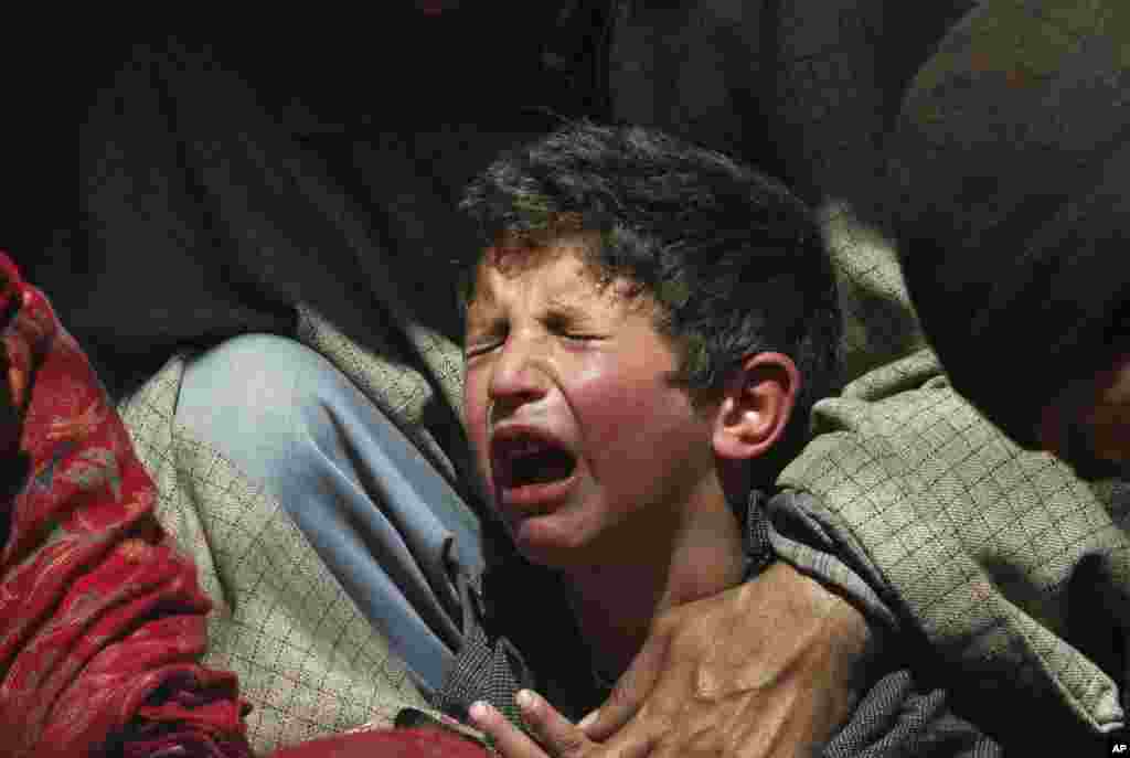 Seorang anak Kashmir menangis setelah seorang pekerja kesehatan tradisional di pinggiran Srinagar, India menggunakan lintah untuk mengisap darahnya sebagai bagian dari pengobatan.