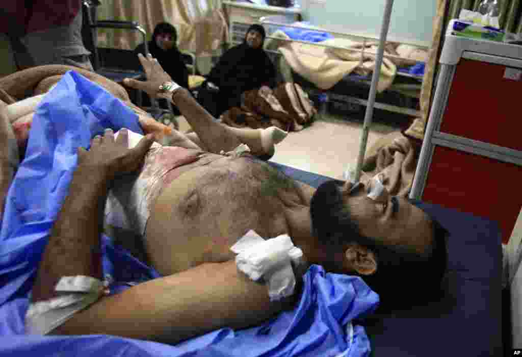 16일 이라크 바그다드 폭탄 테러로 부상당한 남성이 병원으로 이송되었다.