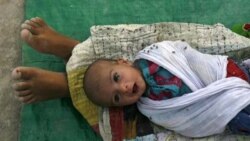 کمبود پروتئین و ابتلای نوزادان زودرس به عفونت های خطرناک