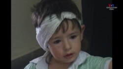 ԱՄՆ-ից անվանի բժիշկ Աքիրա Իշիյիման առաջիկայում Հայաստանում լսողական խնդիրներ ունեցող զինվորների վիրահատություն կիրականացնի