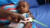 FILE - A muac tape used to screen malnutrition in children at the stabilization ward in Molai General Hospital Maiduguri, Nigeria Nov. 30, 2016. 