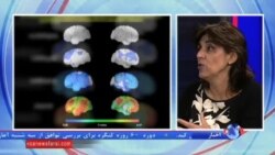 درمان بیماران مبتلا به آلزایمر، آرزویی که به واقعیت می پیوندد