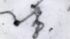 An undated photo made available by the Antwerp Institute of Tropical Medicine in Antwerp, Belgium, shows the Ebola virus viewed through an electron microscope. 