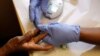 FILE - A patient's finger is pricked for a blood test.