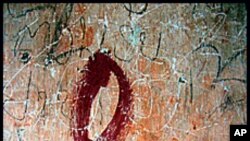 ایچ آئی وی وائرس کے نئے مریضوں میں 20فیصد کمی