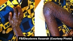 courtesy: FB/Dieudonne Assanah