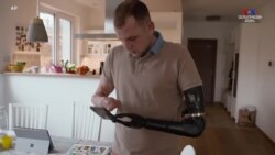 Ճարտարագետը փորձում է արհեստական բանականության միջոցով ավելի դյուրին դարձնել պրոթեզների օգտագործումը