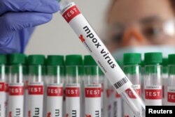 แฟ้มภาพ: หลอดทดลองที่มีป้าย "ผลบวกไวรัสเอ็มพ็อกซ์"