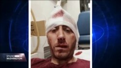 Solidarnost novinara širom zemlje sa napadnutim kolegom Kovačevićem