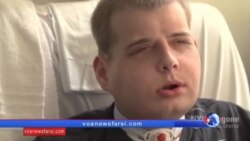 دومین عمل پیوند صورت جهان به آتش نشان آمریکایی چهره‌ای جدید داد