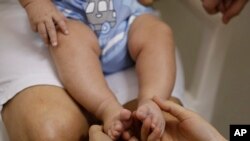 24일 브라질 조아오 페소아 시의 한 병원에서 소두증으로 태어난 아이가 의료진에게 검사를 받고 있다. 최근 브라질을 방문한 일본인 10대 남성이 지카 바이러스에 감염된 것으로 25일 확인됐다. (자료사진) 