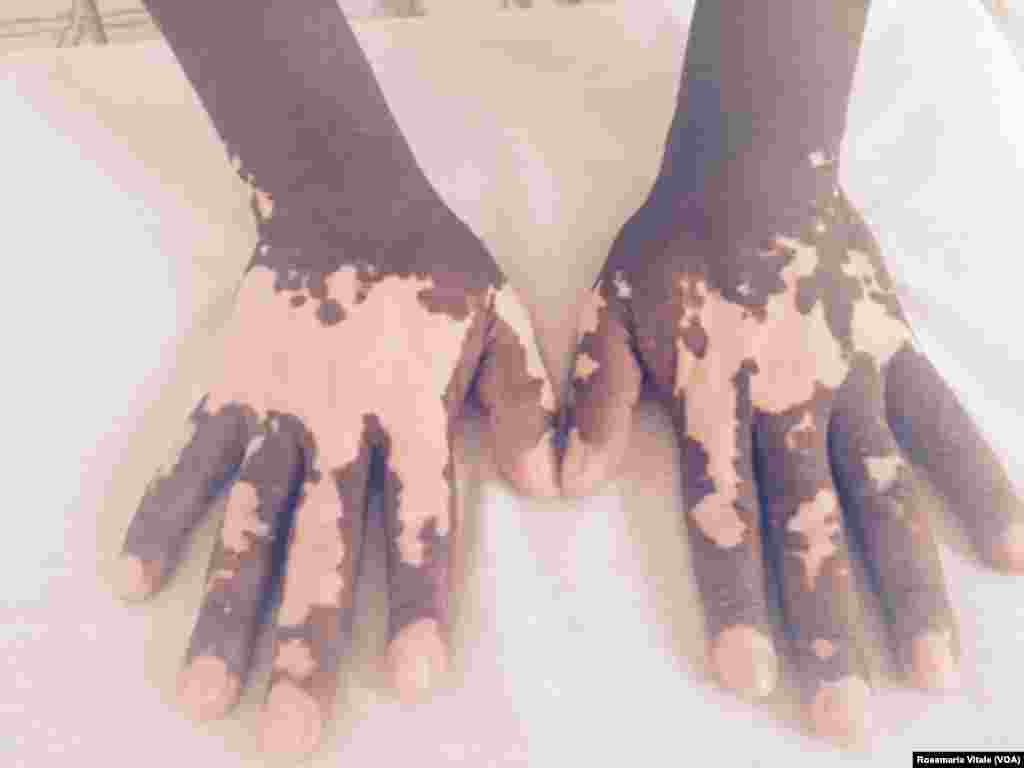 አብ ጉዕዞ ሊብያ-አውሮጳ ብነጋዶ ደቂ-ሰባት ኣእዳው ዝተቃጸለ ስእሊ እቲ ግዳይ አብ ኢጣልያ -ሚላን ስደተኛታት ካብ ዝሕክም ኢጣልያዊ ዝተረኽበ&#39;ዩ