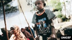 Somali child who lost a leg to a bomb explosion