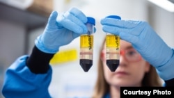In this undated photo from the University of Oxford, a researcher works on the coronavirus vaccine developed by AstraZeneca and Oxford University. (University of Oxford/John Cairns)