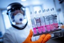 FILE - A research assistant holds coronavirus test samples in her hands in Hanover, Germany, April 1, 2020.