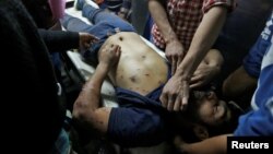 31일 인도-파키스탄 분쟁 지역인 카슈미르 지역의 스리나가르 시에서 인도 경찰과 시위대 간 충돌이 발생한 가운데 부상자가 병원으로 이송되고 있다.