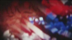 ከምሽቱ 3:00 የአማርኛ ዜና