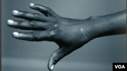 June 26 is International Day in Support of Torture (IRCT)