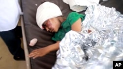 一名在空袭中受伤的也门儿童在萨那医院里被救治。（2018年8月9日）